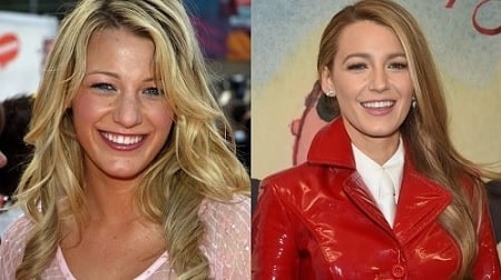 A before and after picture of Blake Lively.